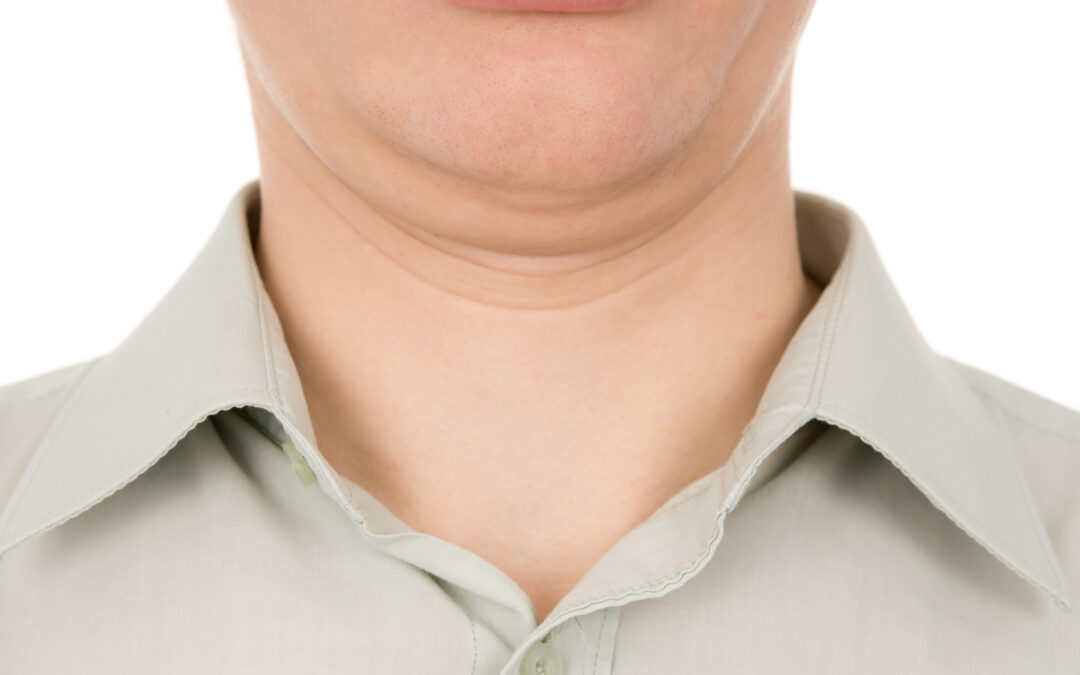 image of skinny guy with a double chin